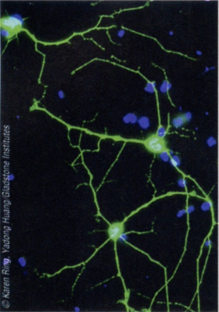Fibroblastes-neurones.jpg