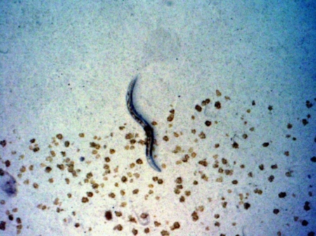 Caenorhabditis elegans.jpg