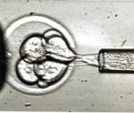 embryon-surnuméraire.jpg