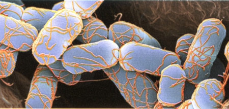 Escherichia-coli-450.jpg